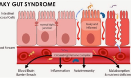 L’hyperperméabilité intestinale ou Leakey Gut syndrome ?